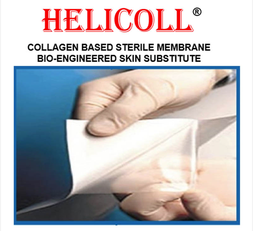 Helicoll Q4164